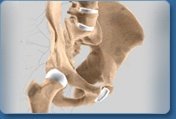 Hip Procedures