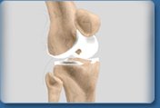 Knee Procedures